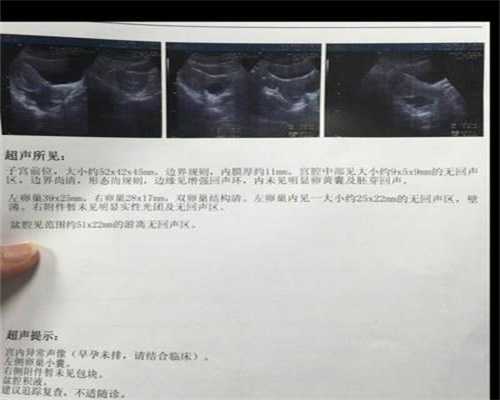 上海代孕网址，正规上海供卵医院，上海哪个医院可以做三代试管
