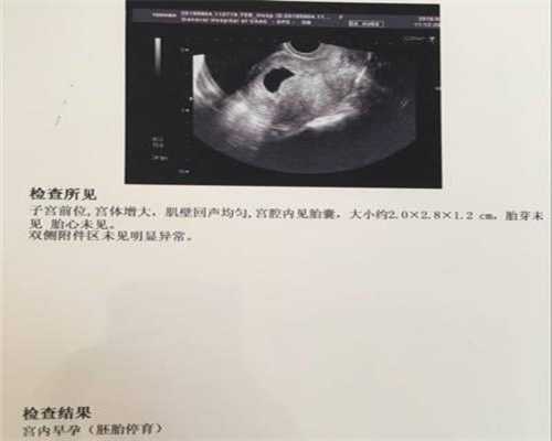 上海试管代孕`上海代怀孕在哪里`上海试管代孕去做要多少钱