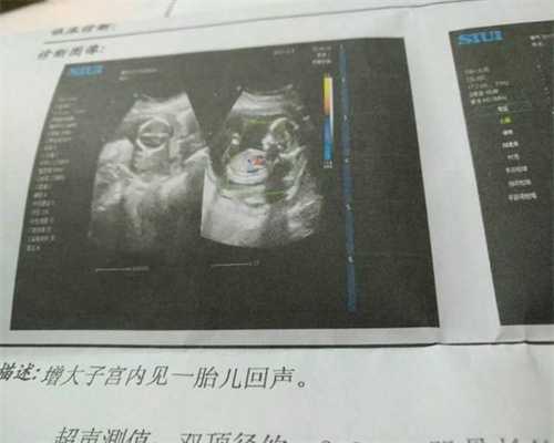 上海代孕风险-上海找人生孩子-上海代怀孕公司合法吗