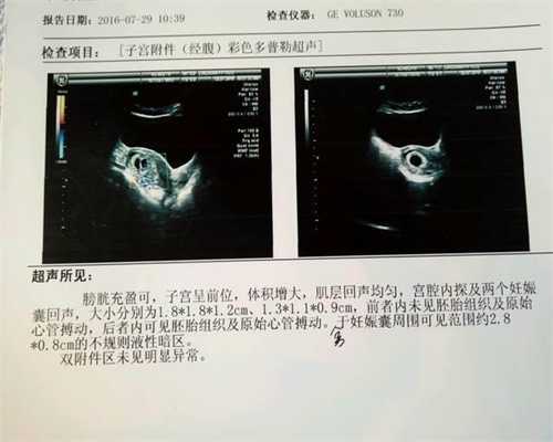 上海爱心代孕-上海代孕中心怎么样-做个上海试管代孕痛苦吗