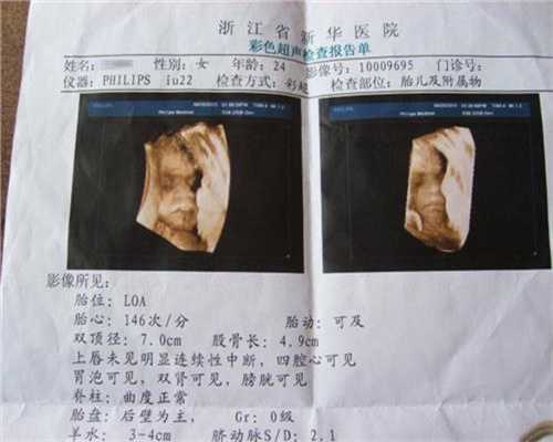 上海代孕生仔~去上海做代孕多少钱~上海人工代孕的女明星