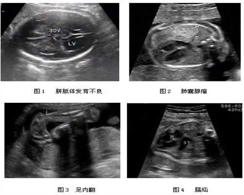 上海代孕服务_上海代孕招聘_上海借卵代孕生子合法吗