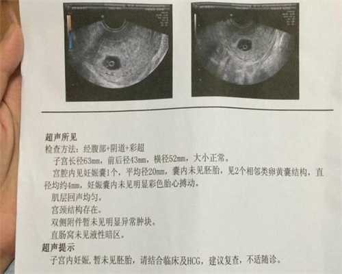 上海如何代孕`上海代孕怎么取卵`上海借腹生子什么医院最好