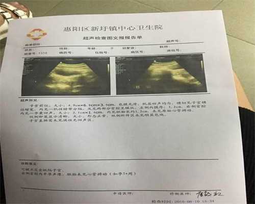 上海代孕协议~上海私人试管医院~上海三代试管代孕可以选男女吗