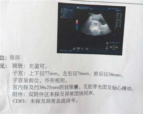 上海代孕产子,上海医院有捐卵子吗,上海代孕龙凤胎多少钱