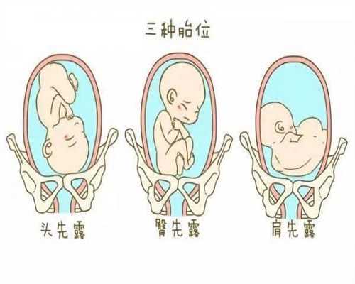 上海代孕移植，做上海试管代孕详解，上海最好的代孕产子机构