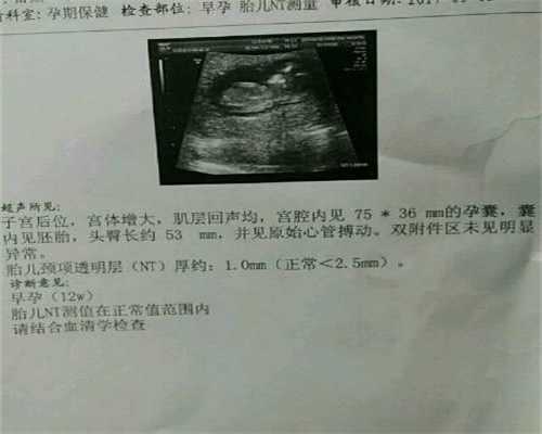上海代孕宝宝，上海性别代孕公司，自己去上海做三代试管