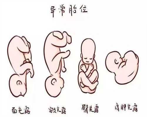 上海二胎代孕,上海代孕馆价格表,怎样上海借卵子生孩子