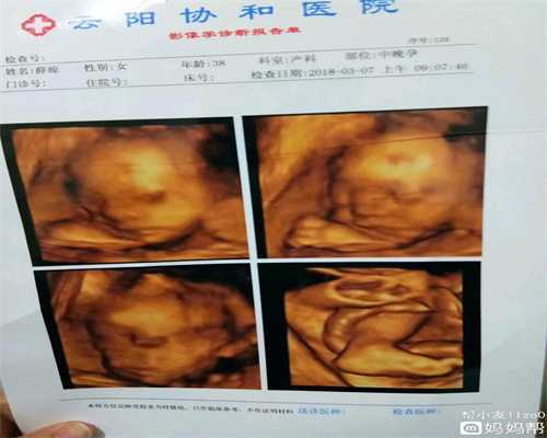 杭州代孕有哪三种类型：整个孕期一般会增重多少