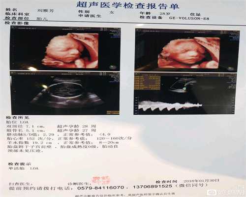 杭州代孕题材的韩剧：宫外孕后多久可以运动