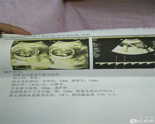 杭州最诚信的代孕公司：孕早期尽量做好2件事