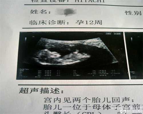 中国代孕价格表_供卵代生一个孩子多少钱_供卵代生孩子新生儿办出生证