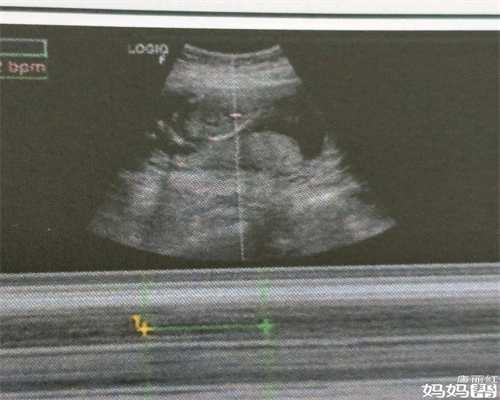 杭州代孕二胎要多少钱：怀孕胃酸可以吃花生吗