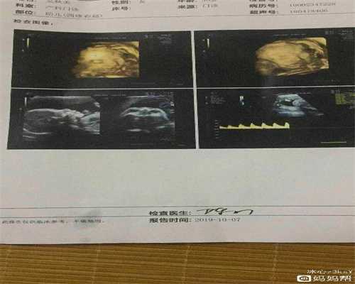 杭州代孕女联系电话：怀孕第一个月发高烧对胎儿有影响吗