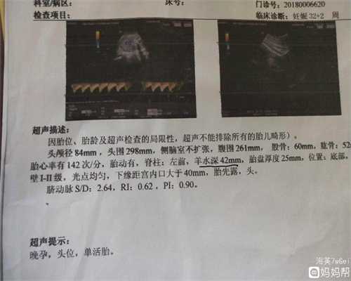 杭州代孕小孩：蓓贝天使助孕网_供卵助孕咨询中心