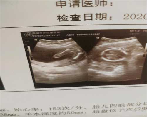 杭州代孕医院地址：代孕生子什么价位_代孕费用是多少钱