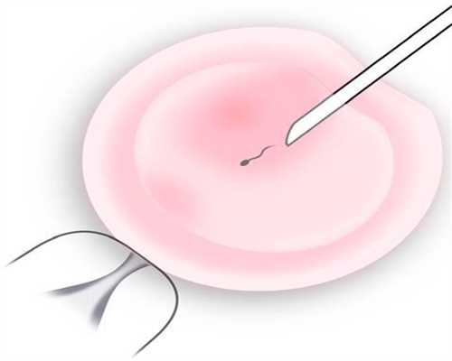 可以合法找人代孕吗-上海供卵流程需要多久_解析试管婴儿流产的四大原因