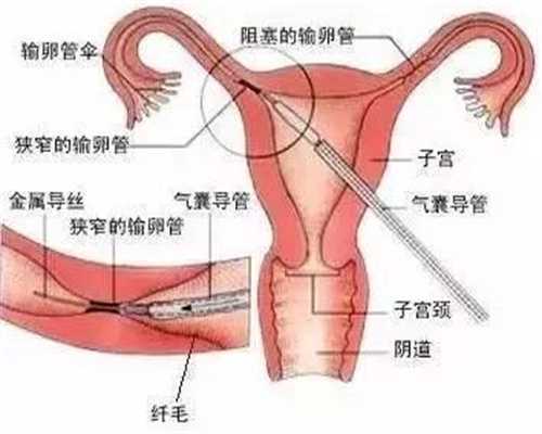 代孕怎么做成功率高-上海南方代孕网_成都泰国试管婴儿人数为什么逐渐增加？